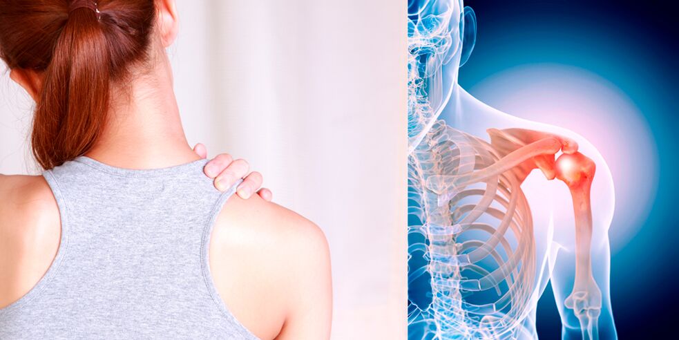 The gradual development of shoulder osteoarthritis causes constant pain