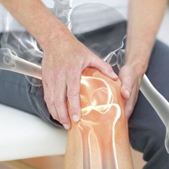 Knee pain may be caused by dislocation